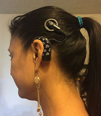 Lisa Yuan showing her cochlear implant